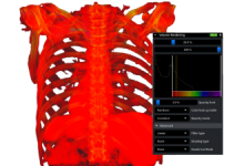 how-online-dicom-viewers-cut-image-review-time-in-half