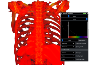 how-online-dicom-viewers-cut-image-review-time-in-half